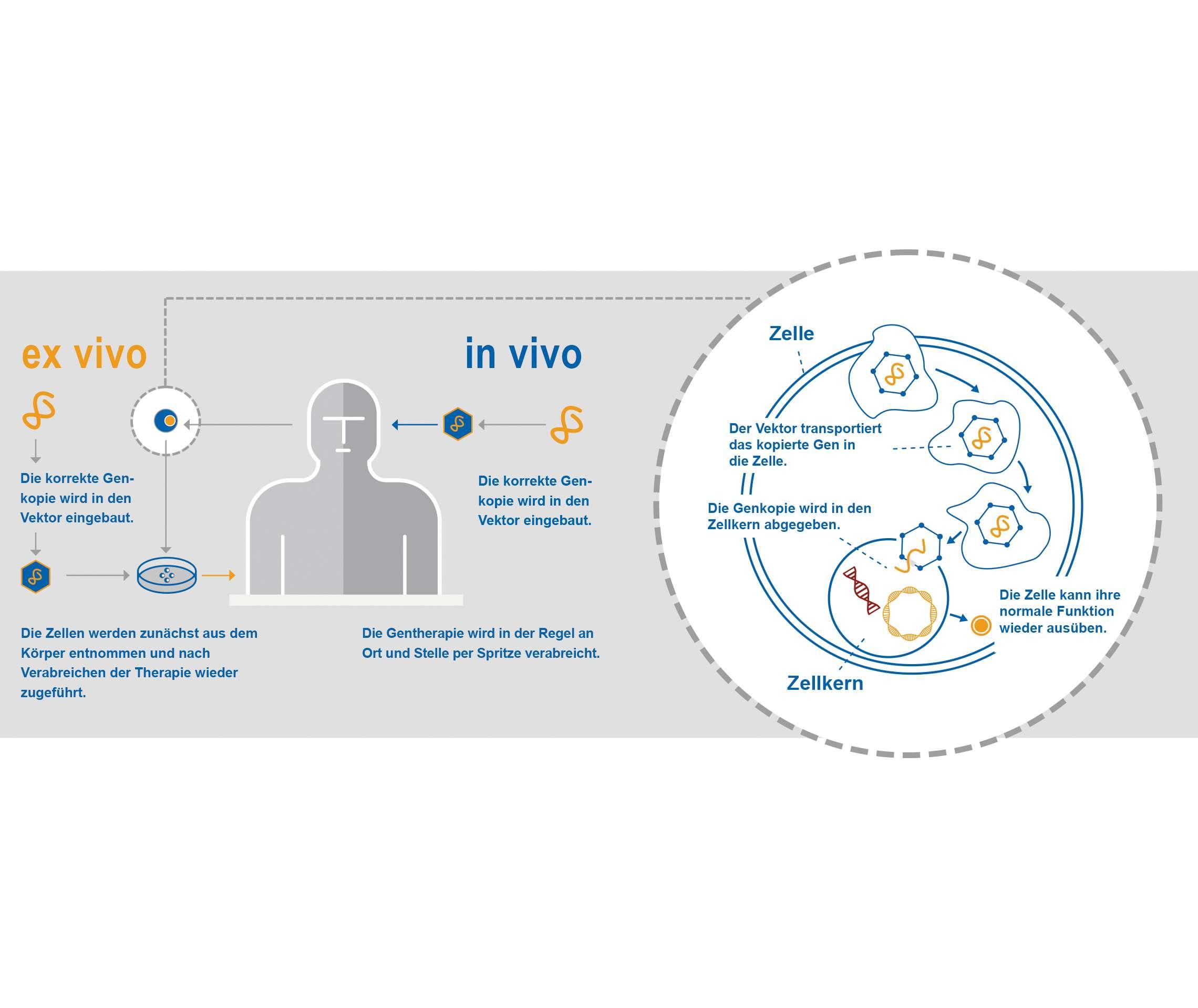 Grafik Gentherapie
