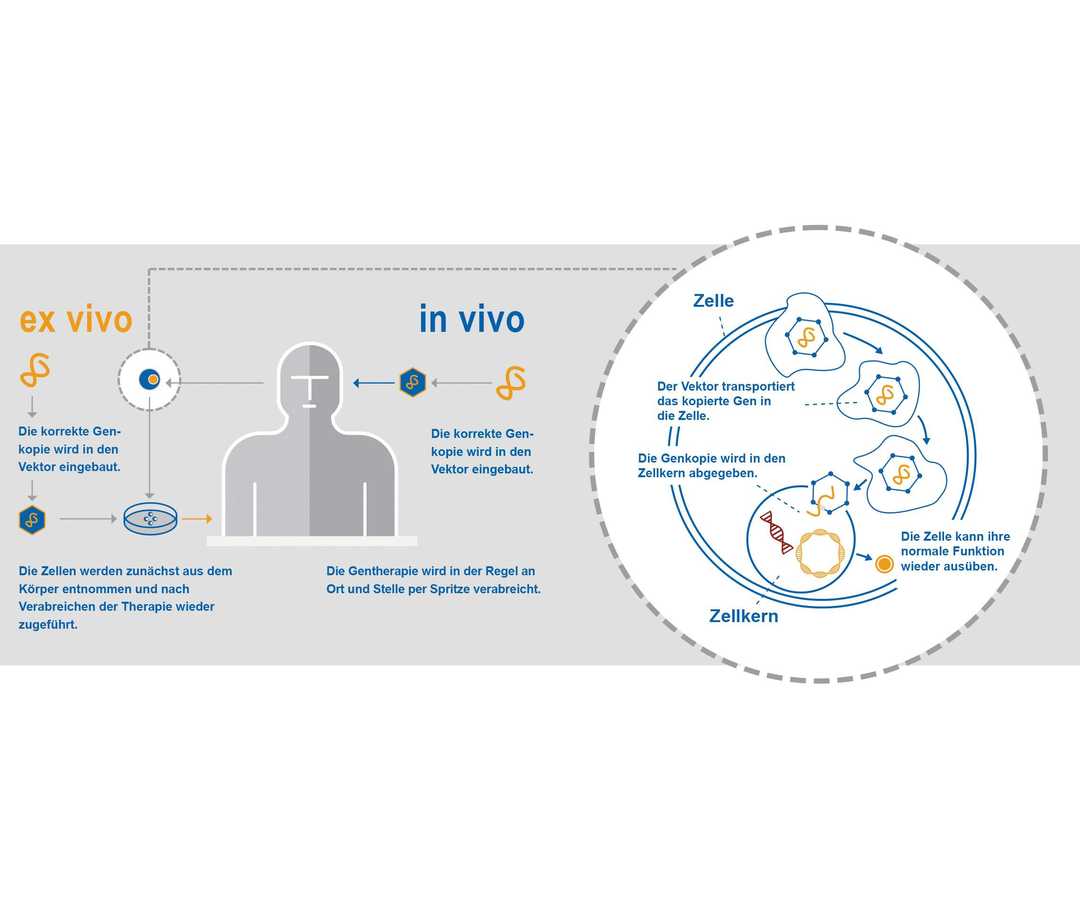 Grafik Gentherapie Grafik Gentherapie