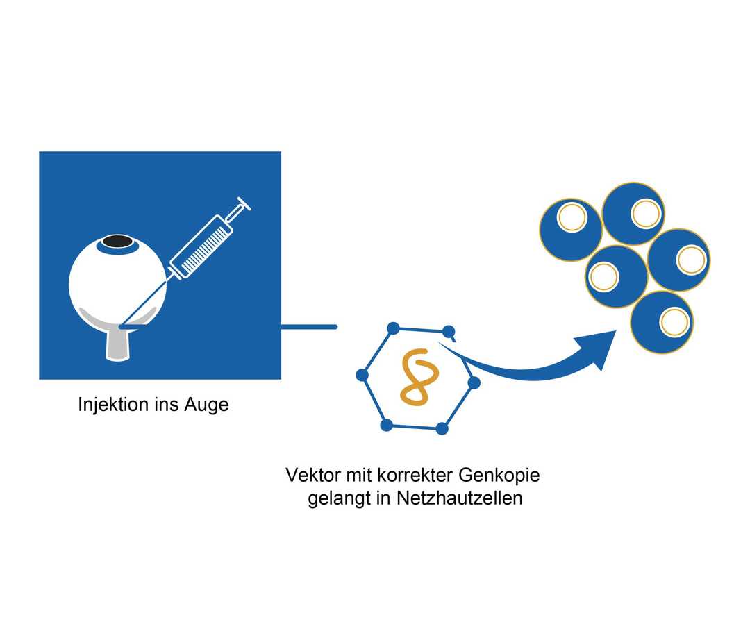 Grafik Netzhautzellen