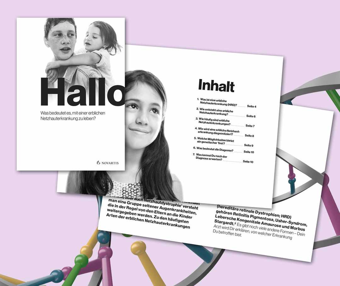 Erbliche Netzhauterkrankungen: Teaserbild zum Download der Patientenbroschüre Erbliche Netzhauterkrankungen: Teaserbild zum Download der Patientenbroschüre